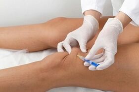 knee joint injections for osteoarthritis