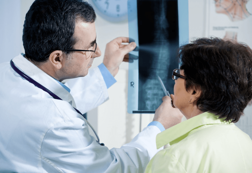 A neurologist diagnoses osteochondrosis using an x-ray of the spine.